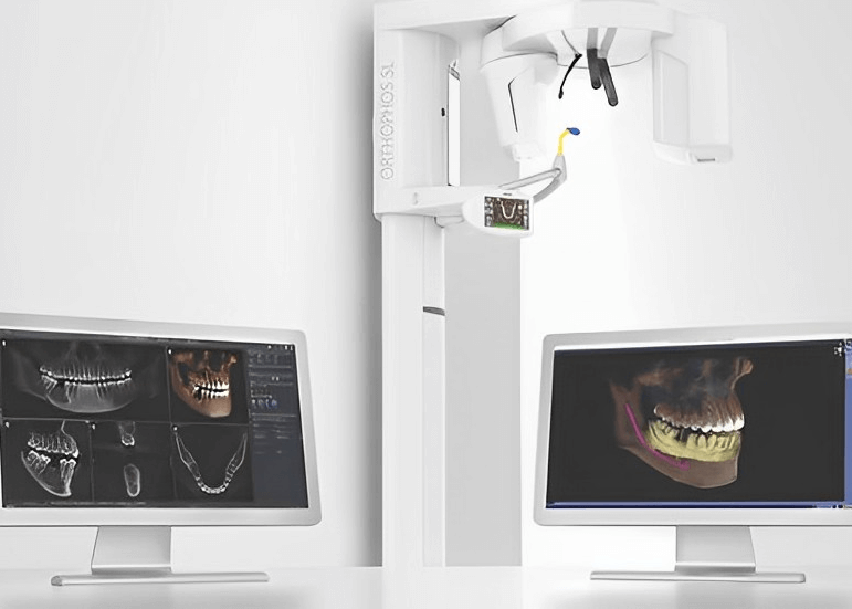 Implantes Guiados por IA 1