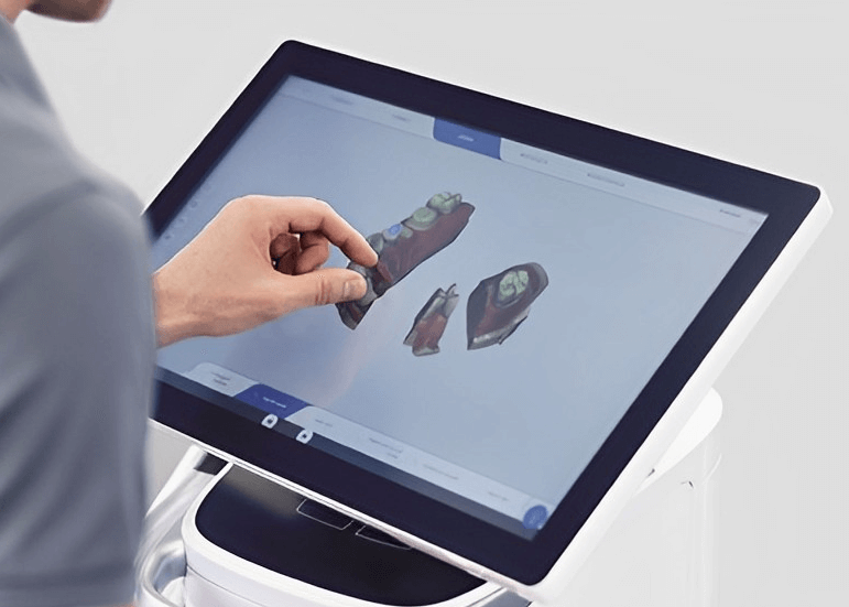 Implantes Guiados por IA 3