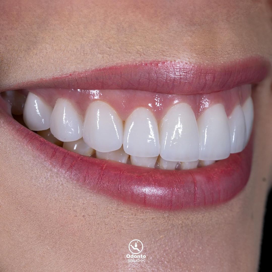 Snapinsta.app_457881307_1979462519155404_3102433819805346042_n_1080