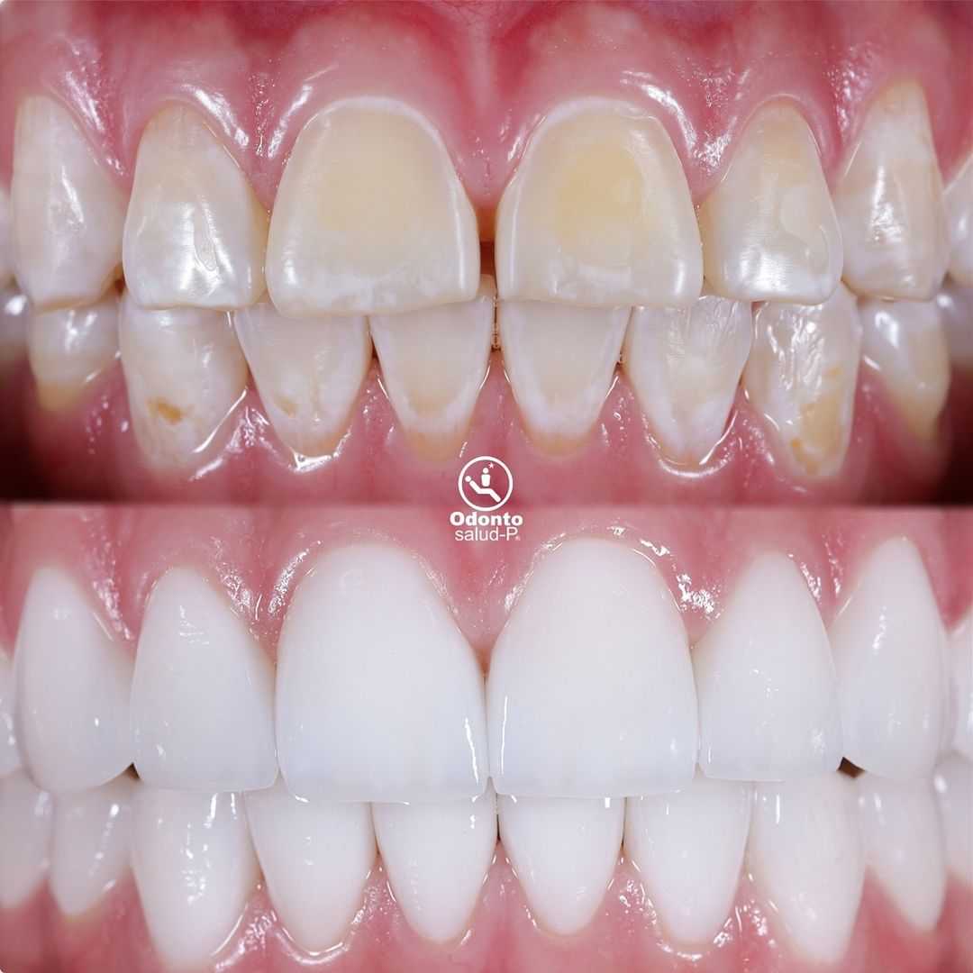 Snapinsta.app_462245505_382506651622617_8607543656023015298_n_1080