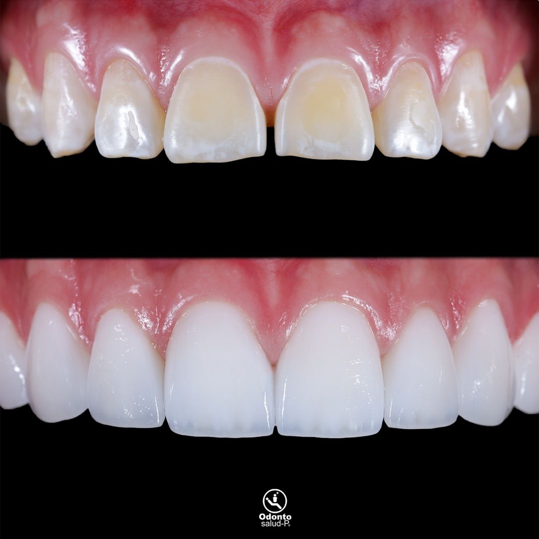 Snapinsta.app_462285259_3736994113218845_8427203211852774722_n_1080